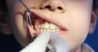 المصادقة على مرسوم تطبيقي يهم نظام التأمين الإجباري الأساسي عن المرض ونظام المعاشات الخاصين بأطباء الأسنان
